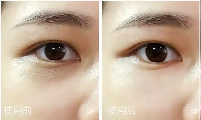 大眼袋?眼睛肿?黑眼圈?小细纹?靠它就能轻松搞定!