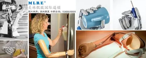 十五年假肢专家告诉您什么是索控假肢手