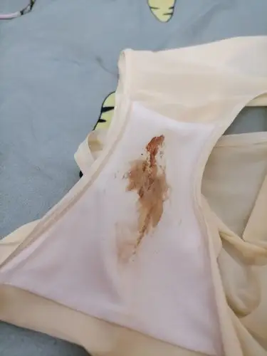 怀孕初期出血这颜色是怎么回事?