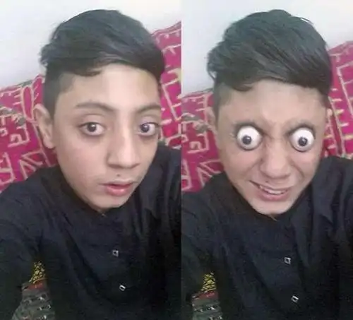 巴基斯坦少年因「这样」眼珠弹出,下一步居然想挑战「金氏纪录」!