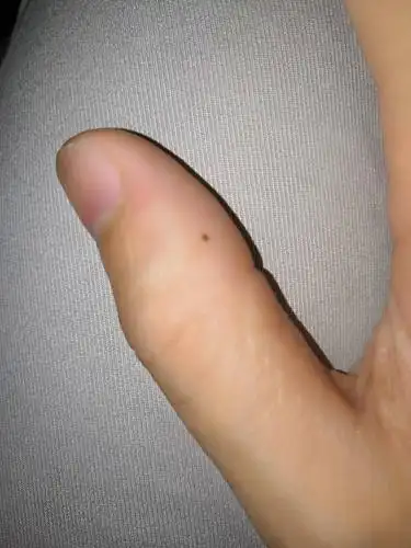 我想说我这大拇指边上的小痣是什么意思呀!哪位大神能帮我解答下.谢谢