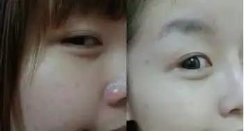 美白须知:六类人群不可注射美白针