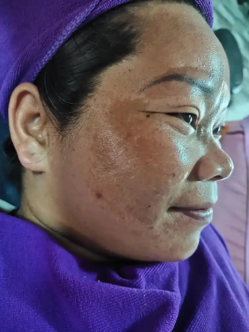 大黑脸调肤效果图#解决任何皮肤问题  - 抖音