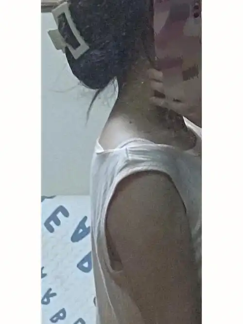 家人们,这该怎么办#斜方肌  #消除斜方肌  #体态改善  #体态矫正