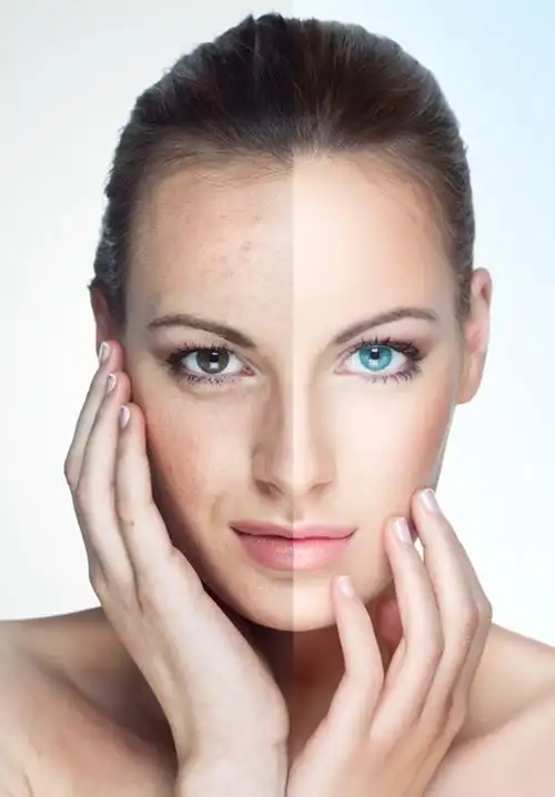 你的肌肤"口渴"了,你知道吗?