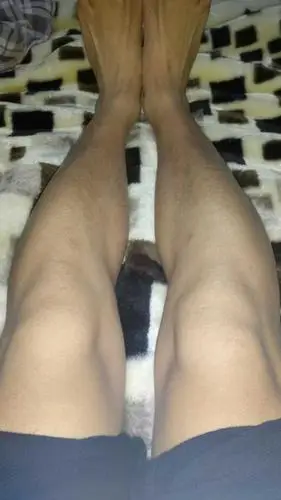 女孩子,膝盖内突很厉害.