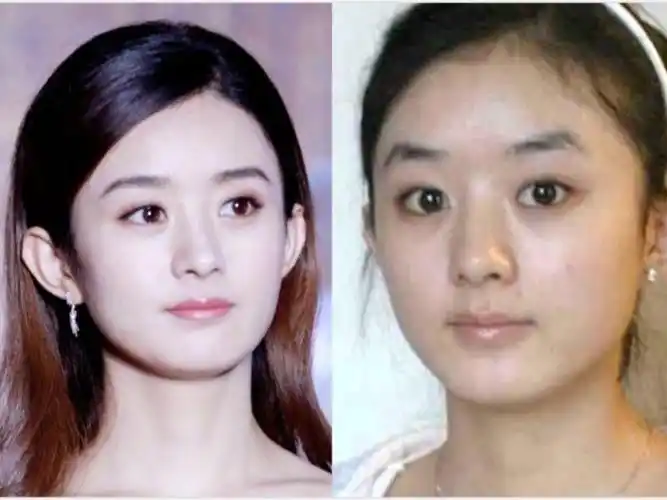 赵丽颖颜值优缺点56615在后来的剧中,你会发现她颜值_圈子-新氧