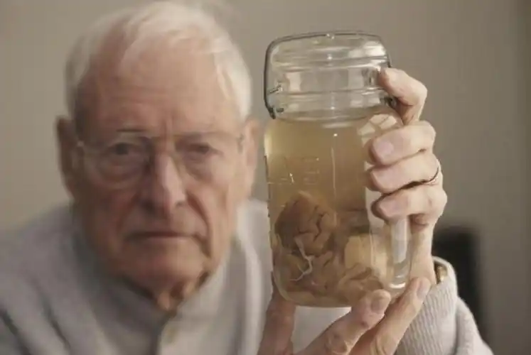 爱因斯坦的大脑被切成240块,当成纪念品,随便送人?