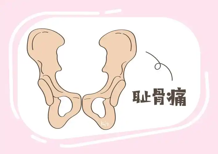 怀孕期间,这5类女性要注意,"耻骨痛"更容易"盯"上你