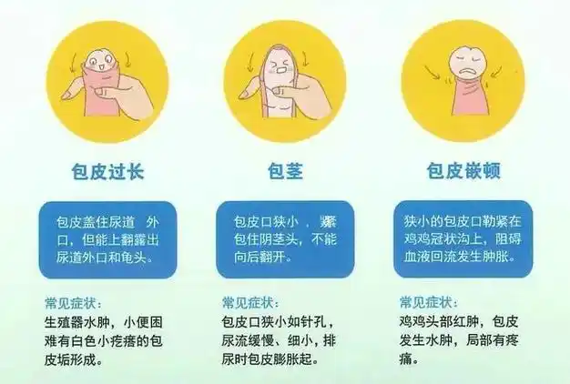 是割还是留,答案在这里!|手术|包茎|环切|吻合器_网易订阅