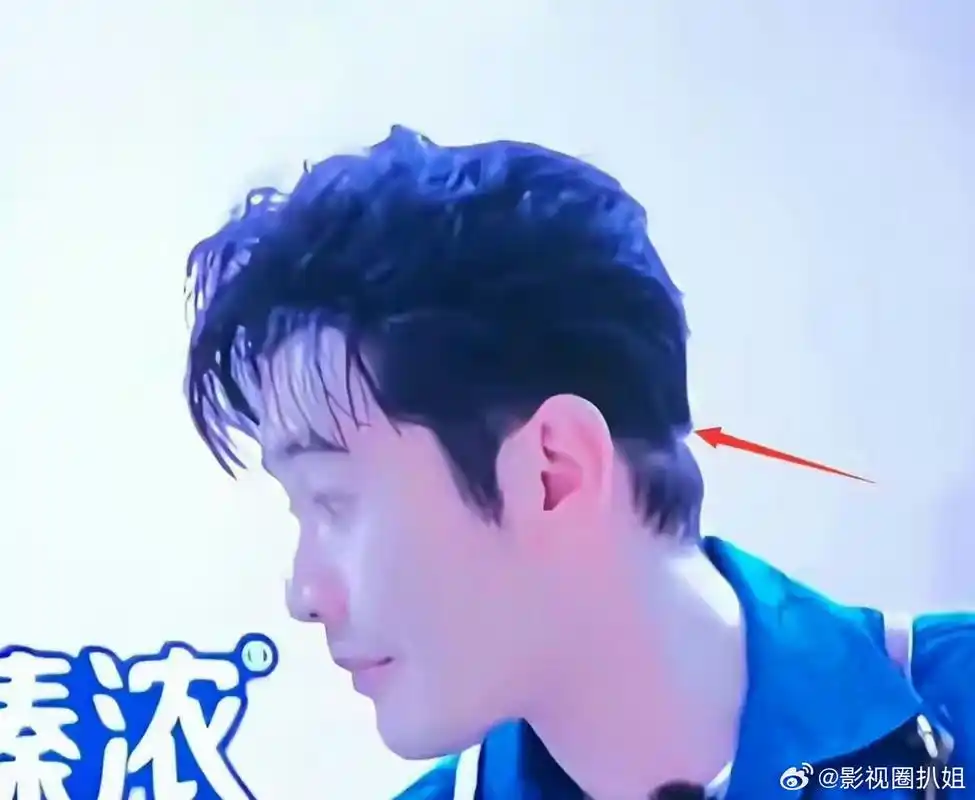 黄晓明疑似脱发严重,中餐厅7中,他的脖子上方头发形状奇怪,像是戴着一