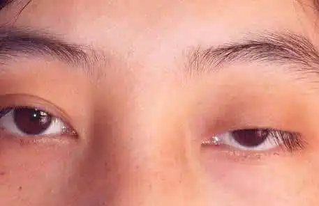 眼睛干涩飞蚊症老花眼白内障戴上它让眼睛恢复健康