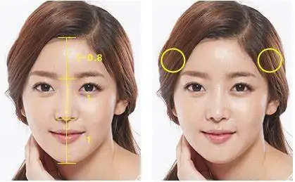 如何确定前发际线的正确位置?