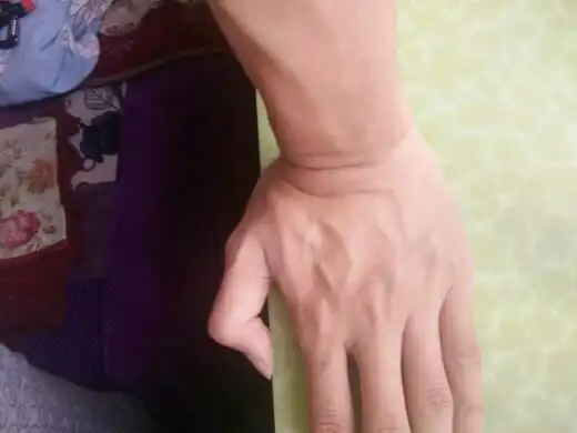 我全身皮肤松弛全是皱纹才18啊,好几年了