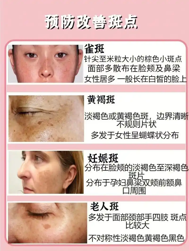 如果你的皮肤也长斑点了,一 - 抖音