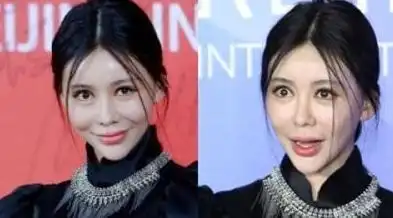 娱乐圈十大整容失败明星排行榜,萧蔷整容惨不忍睹