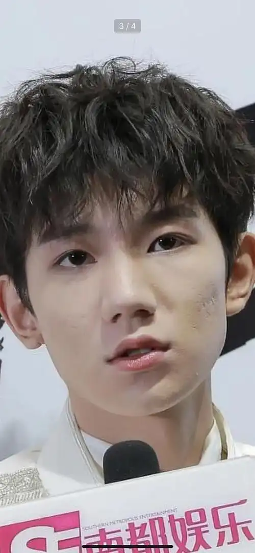 王源的痘坑和痘印比较严重,可以用点阵激光和红蓝光,微针去