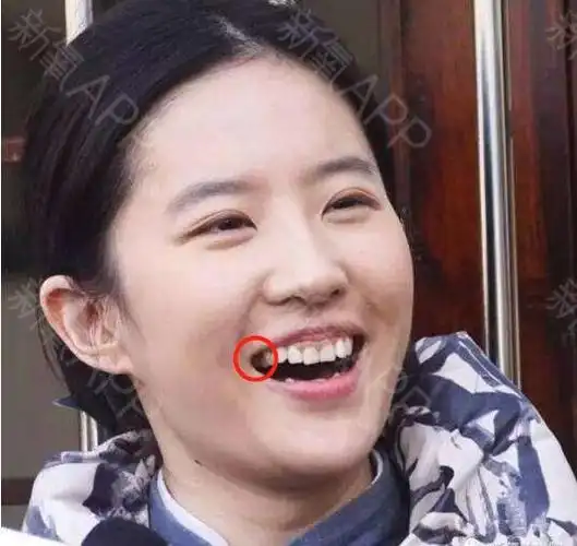 新氧- 迷死氧 | 北京同城 | 娱乐八卦 | 深扒明星整形史