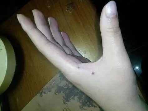 女人左手虎口有痣,女人左手虎口有痣寓意