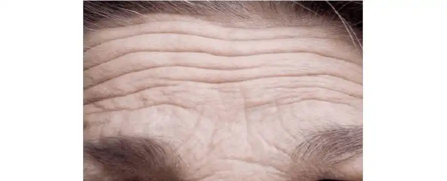 脸上的皱纹反映了你的健康状况和生活方式,赶紧对照着调整吧!_皮肤