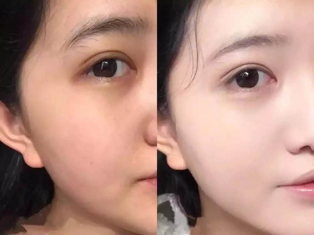 懒girl的裸妆秘密神器有了ta遮瑕提亮10秒就能get少女的粉嫩奶油肌