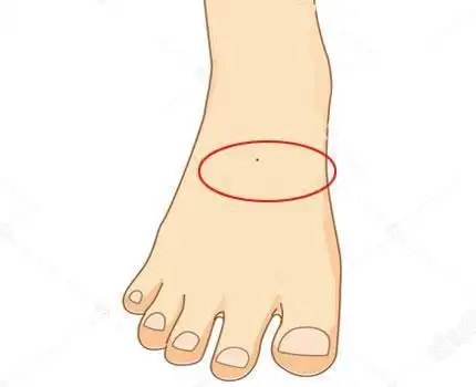 脚上这些地方长痣的男人看好了一笔突如其来的横财来了请接收