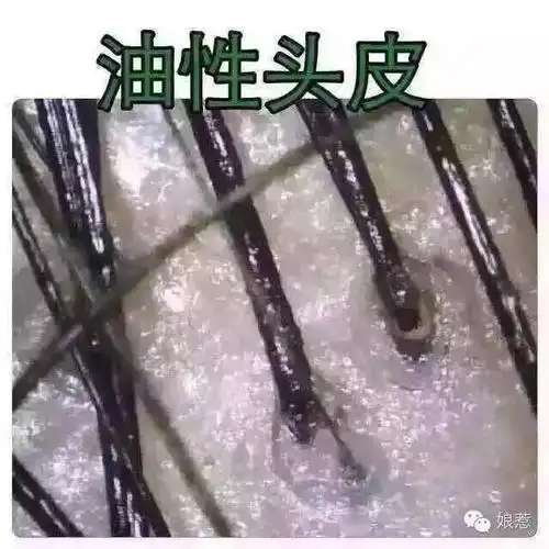 头皮专业知识了解头皮了解健康