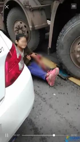 宜宾一骑电动车女子被大罐车碾压,手臂血肉模糊,连骨头都看到了!
