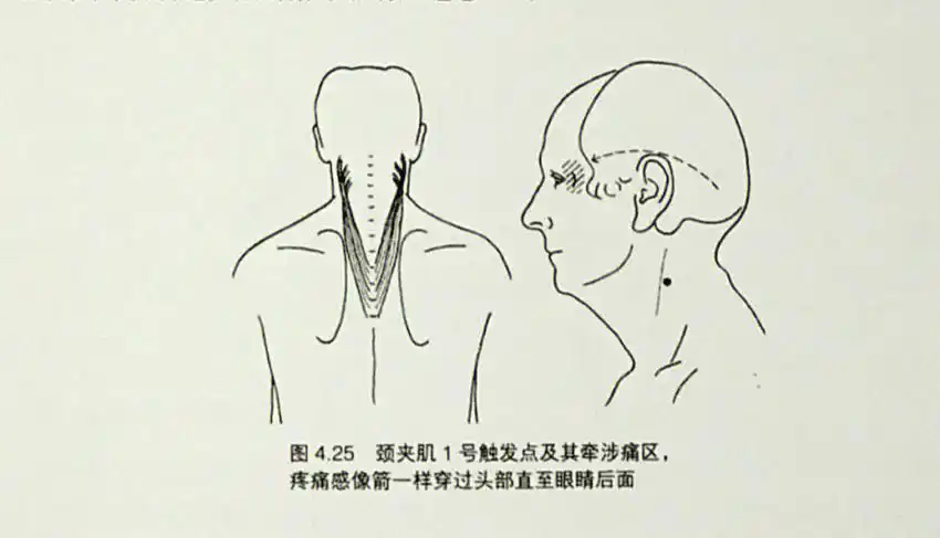 颈后肌群颈夹肌