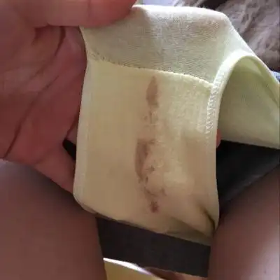 有褐色分泌物,正常吗?怀孕42天