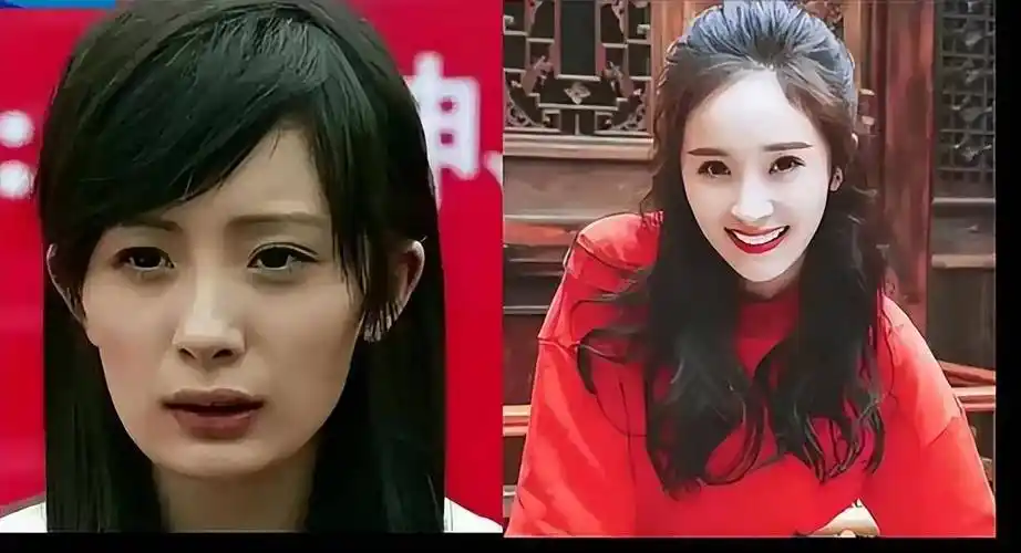 削骨整容的后遗症已出现,年纪越大越明显_杨幂_脸部_情况