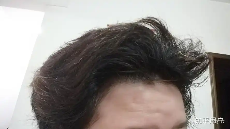 本人发质沙发新生发质粗硬干蓬松不拉直就是狮子王除了拉发有护发养发