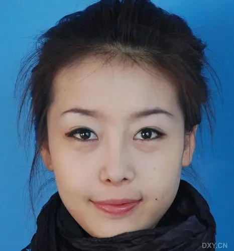 术后包扎: 半侧脸: 侧面照片: 稍仰面: 仰面: 右半侧面: 右侧面: 做一