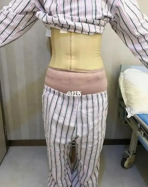 记录第17天我的腰腹情况_腰腹_消肿_环吸_南瓜粥_薏仁水_腰腹环吸