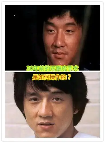 成龙大哥的双眼皮是割的!果真是走在娱乐圈前沿的人