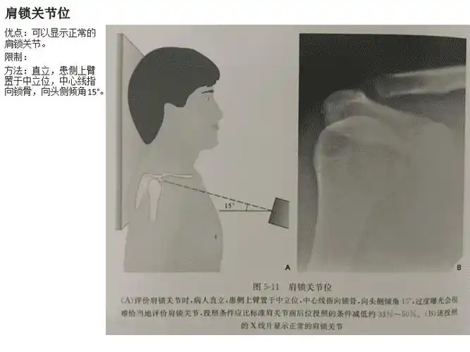 不同肩关节x线投照位-莲山文库