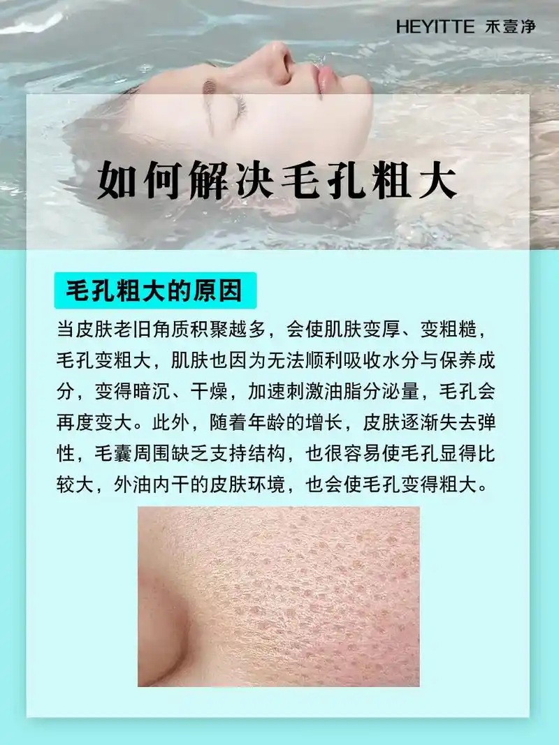 皮肤管理 | 如何解决毛孔粗大?#美容院加盟 更多皮肤管理 - 抖音