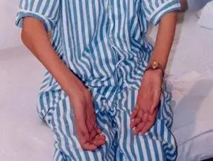 重症肌无力的病因及预防