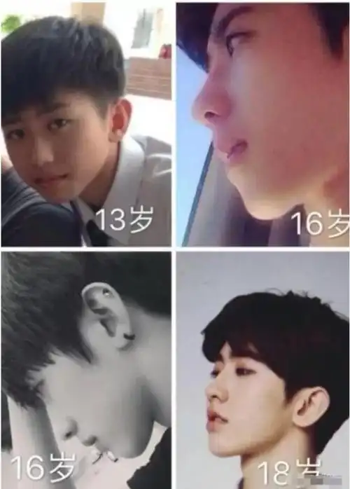 自出道以来,就有不少人拿以前的照片对比,来质疑蔡徐坤整容,对此