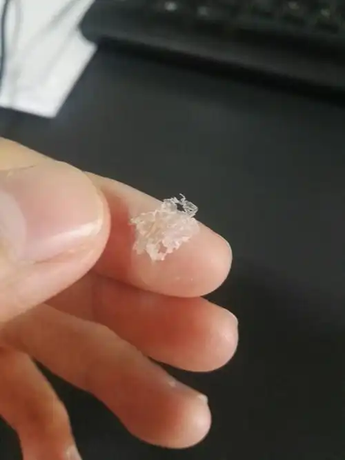 为什么抠下来大块的头皮屑会有瞬间的快感? - 知乎