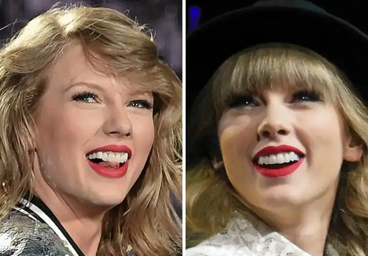 一个无聊而认真的研究:如何肉眼识别明星的假牙?