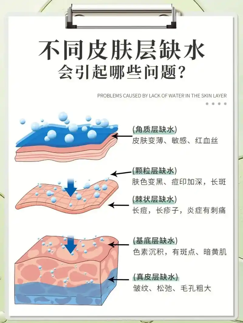 不同肌肤层缺水会引起皮肤哪些问题?#护肤 #知识分享 - 抖音