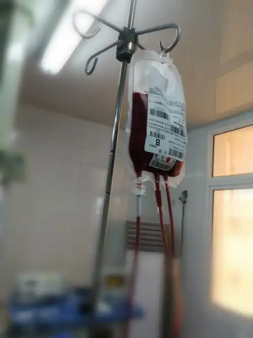 危急时刻显身手之妇科异位妊娠伴出血