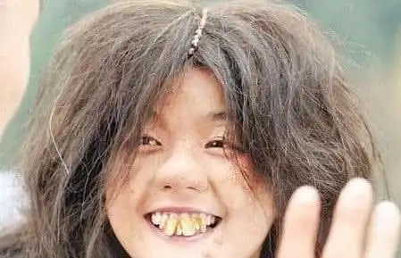 演丑女的女星:张芷溪龅牙,郑秀文肥胖,蔡妍卓无人能及