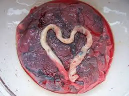 人胎盘详细的特征图片