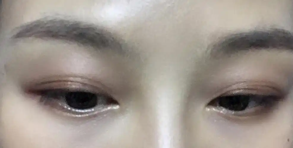 眼皮好像越来越多层了.