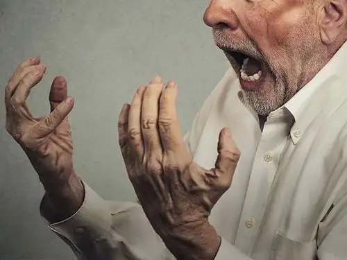 治疗老年痴呆症相关躁动症axs05前景可期