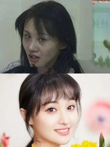 郑爽为爱整容成功逆袭盛世美颜!