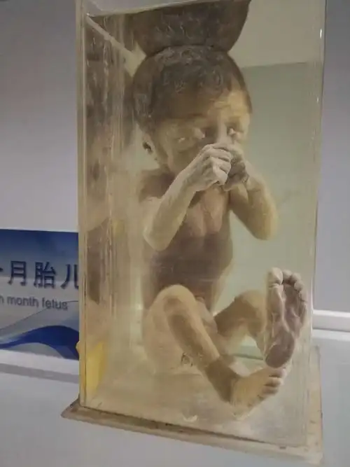 的重头戏——各种人体标本 看着一个个鲜活的生命被浸泡在福尔马林里