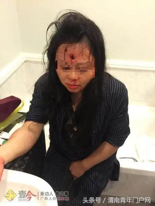 3名国人南非旅游遭抢劫 母女头部中枪